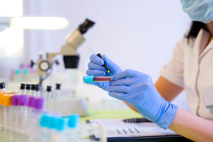 Prioritisation concerns of Covid-19 vaccine for society’s most vulnerable
